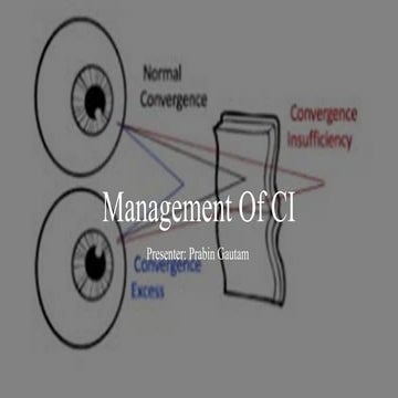 Convergence & its anomalies | PPTX