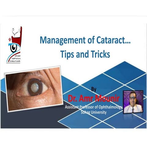 Management of Cataract