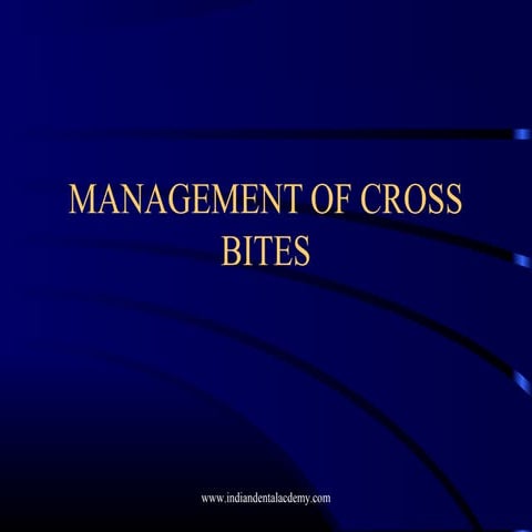 Management of cross bite  /certified fixed orthodontic courses by Indian dent...