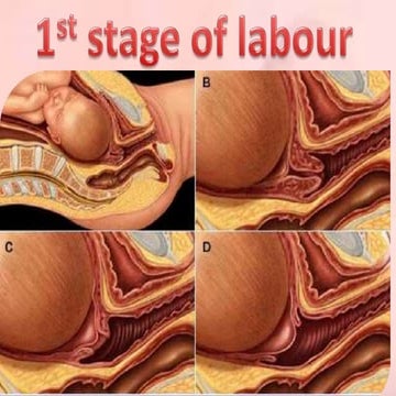 Management of first stage labour