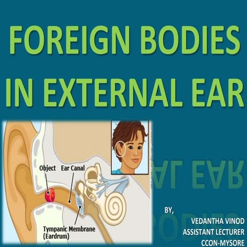 Management of foreignbody in ear
