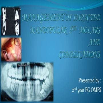 Management of impacted3rd molar