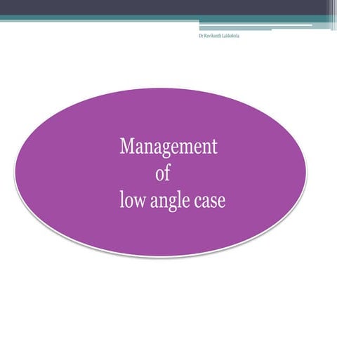 Management of low angle case in orthodontics
