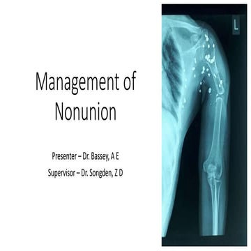 Management of Nonunion