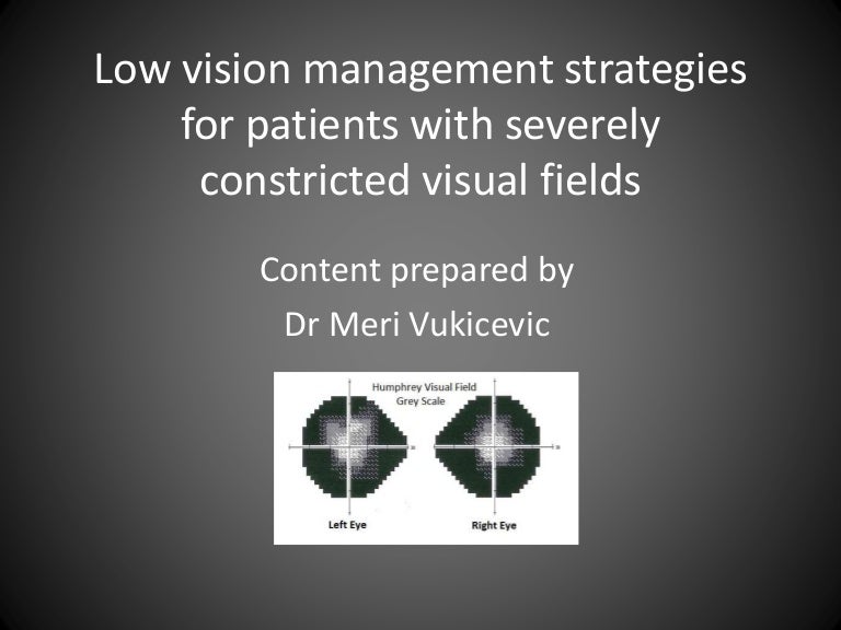 Management of peripheral vision loss