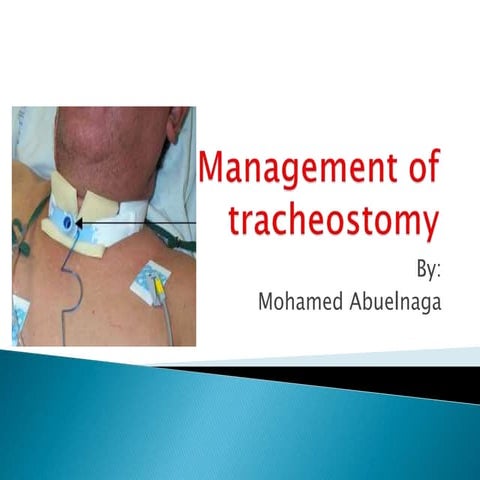 Management of tracheostomy