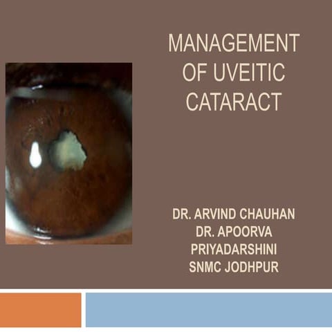 Management of Uveitic Cataract