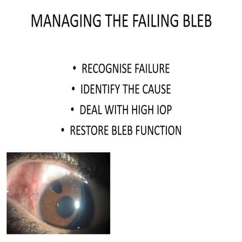 Managing the failing bleb