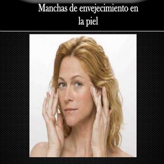 Como Eliminar las Manchas de enveje...