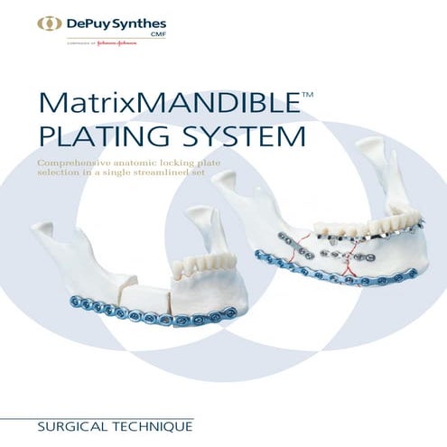 maxillofacial surgery implants | PDF | First Aid | Injuries