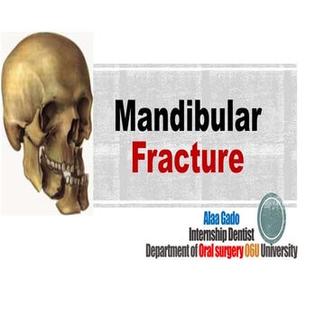 Mandibular Fractures