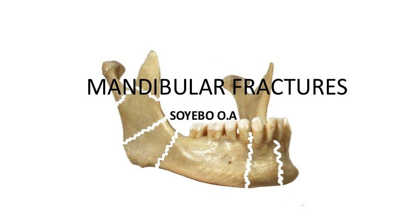 Complications of mandibular fracture