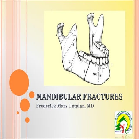 Mandibular fractures