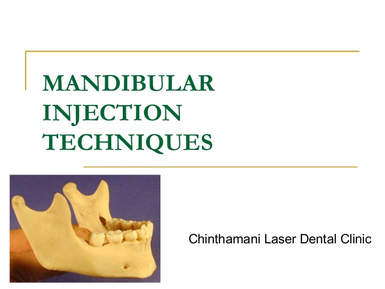 Mandibular Injection Technique