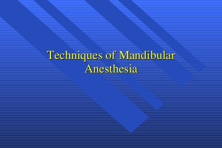 Mandibular nerve block
