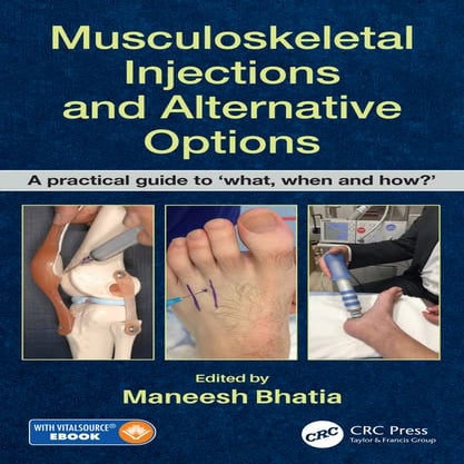 Maneesh Bhatia (Editor) - Musculoskeletal Injections and Alternative ...