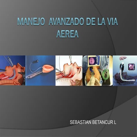 Manejo avanzado de la via aerea