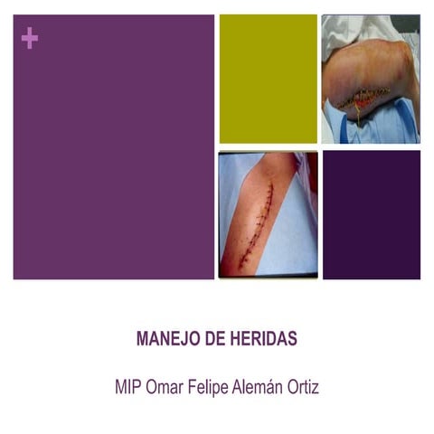 Manejo de heridas 