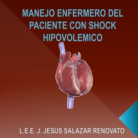 Manejo enfermero del paciente con shock hipovolemico | PPTX