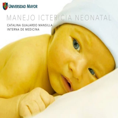 Manejo ictericia neonatal 