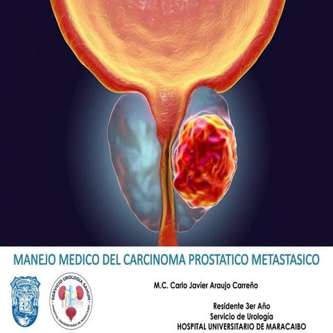 REIMPLANTE URETERAL TECNICAS QX2023.pptx