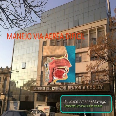 Manejo via aerea dificil