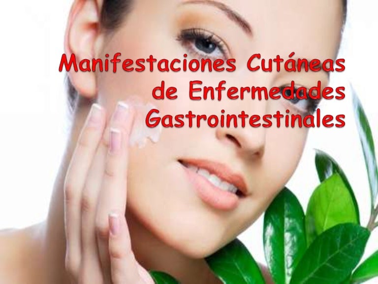 Dermatosis neutrofílica febril aguda Síntomas de diabetes Dermatosis neutrofílica febril aguda Síntomas de diabetes