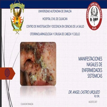 Manifestaciones nasales de enfermedades sistemicas
