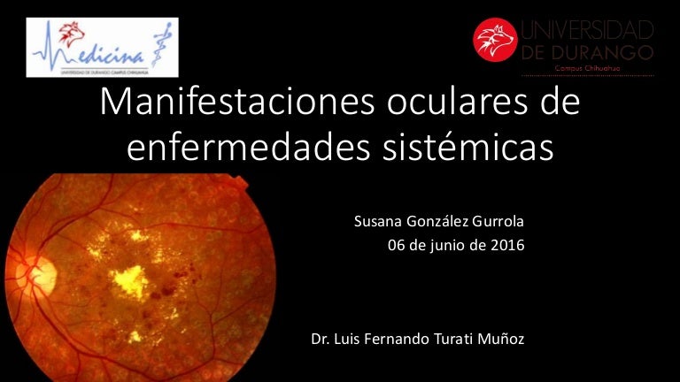 síntomas de diabetes de neovascularización ocular