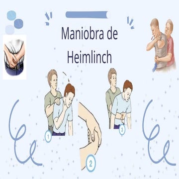 Maniobra de Heimlich | PPTX