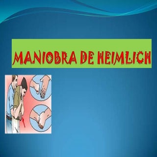 Maniobra de heimlich 2014