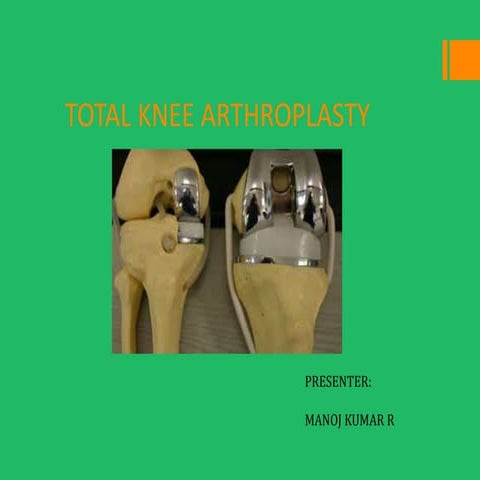 TOTAL KNEE REPLACEMENT