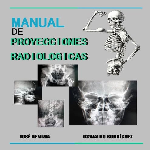 TECNICA DE VON ROSEN.pptx