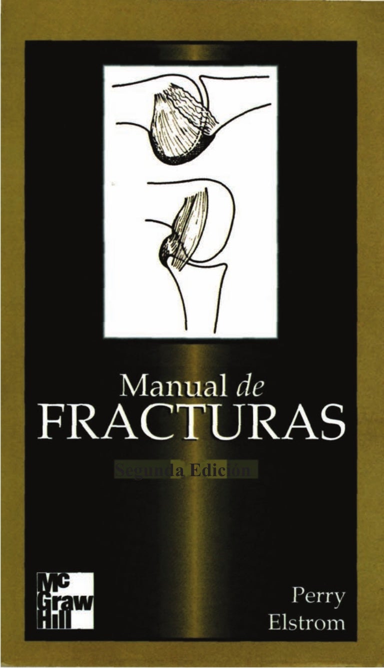 fracturas de la meseta tibial epidemiología de la diabetes
