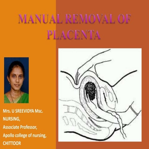 Manual Removal of Placenta