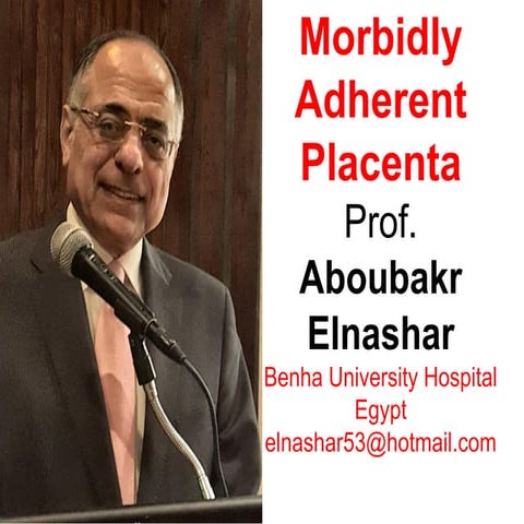 Morbidly adherent placenta