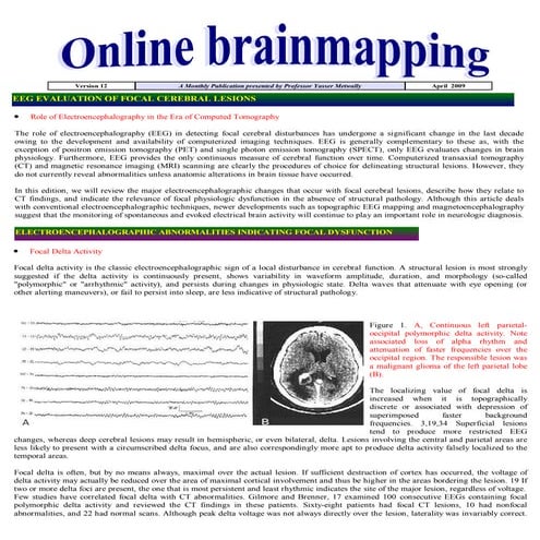 Issues in brainmapping...EEG in the evaluation of focal cerebral dysfunction