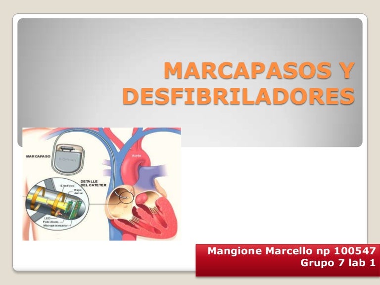 Diferencia Entre Marcapasos Y Desfibrilador Marcapasos
