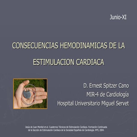 Consecuencias Hemodinámicas de la Estimulación Cardiaca