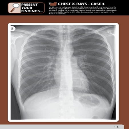 Guide to Radiology | PDF