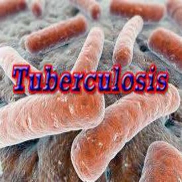 La tuberculosis (TB).pptx (ENFERMEDAD) | PPTX