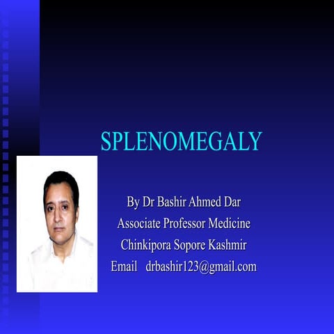 Massive Splenomegaly By Dr Bashir Ahmed Dar Chinkipora Sopore Kashmir Associa...