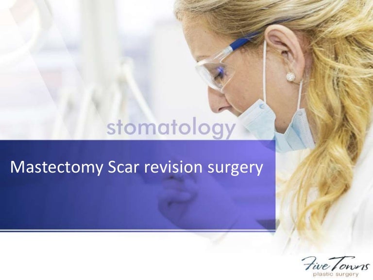 Mastectomy scar revision surgery