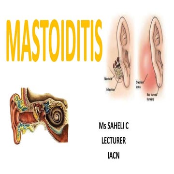 Mastoditis 170811051118