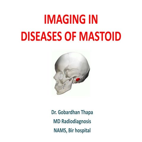 Mastoid diseases imaging