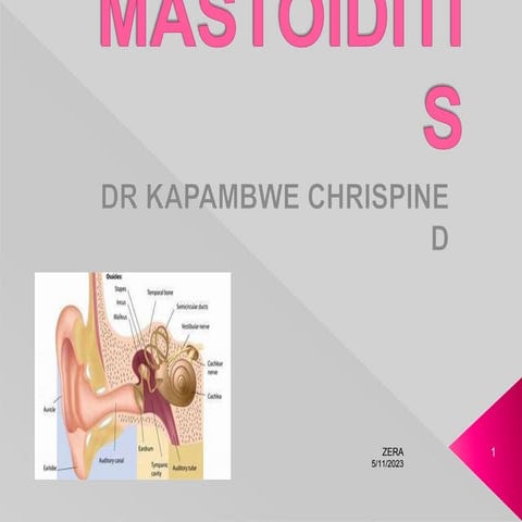 Mastoiditis.ppt
