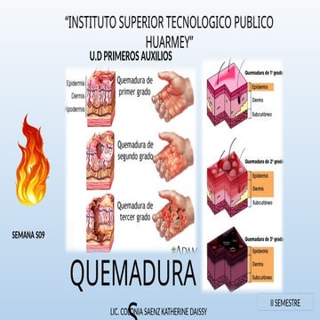 MATERIAL S09 MANEJO DE QUEMADURAS , todo sobre quemaduras | PPTX