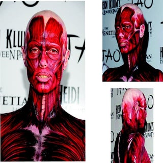 Material utilizado tercera visita