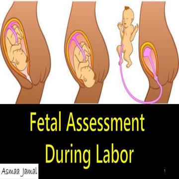 Fetal Assessment  During Labor