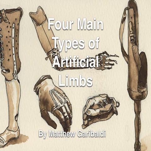 Four Main Types of Artificial Limbs, by Matthew Garibaldi